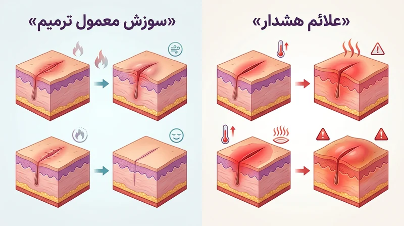 اینفوگرافیک تفاوت سوزش طبیعی و عفونت در درمان درد بعد از ابدومینوپلاستی